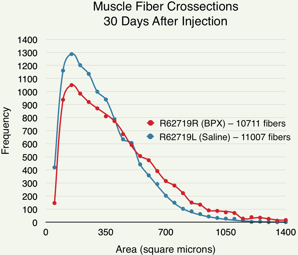 Effect of BUP injection on fiber size
